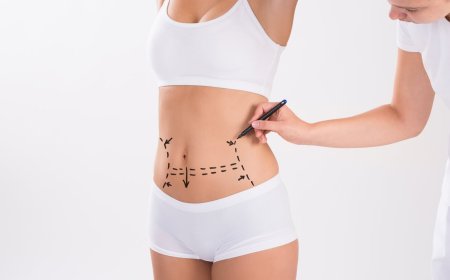 Liposuction in Dubai: Liposuction for the Face and Neck – What You Need to Know