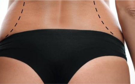 Body Contouring in Dubai: Transform Your Shape with Customized Aesthetic Solutions
