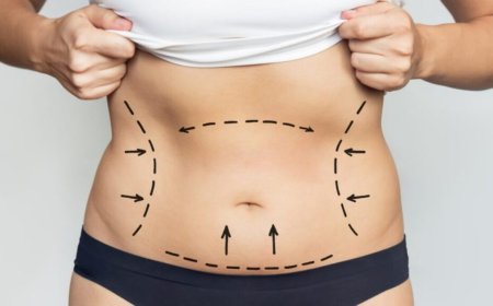 Smart Preparation Smooth Results Advice from Best Liposuction Surgeon in Dubai