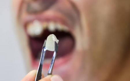 How Dentists Handle Emergency Tooth Extractions Safely and Quickly