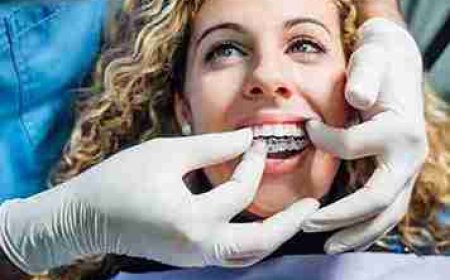 Moving Toward a Confident, Straighter Smile in Hounslow