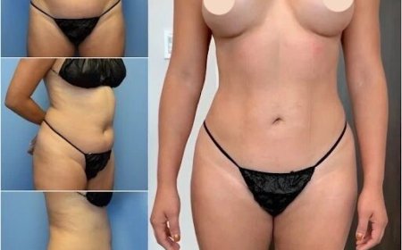 Discover How the Best Body Contouring Surgeon in Dubai Achieves Best Results