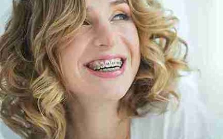 Invisalign: A Modern Fix for Common Bite Challenges