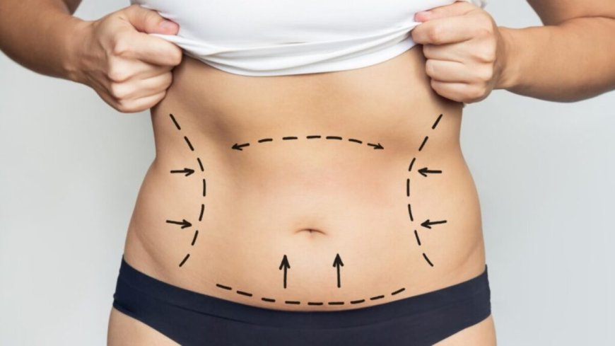 Smart Preparation Smooth Results Advice from Best Liposuction Surgeon in Dubai