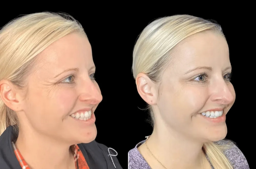 Why the Best Aesthetic Clinics in dubai Are the First Choice for Botox
