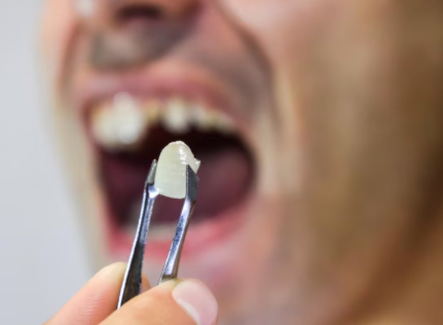 How Dentists Handle Emergency Tooth Extractions Safely and Quickly