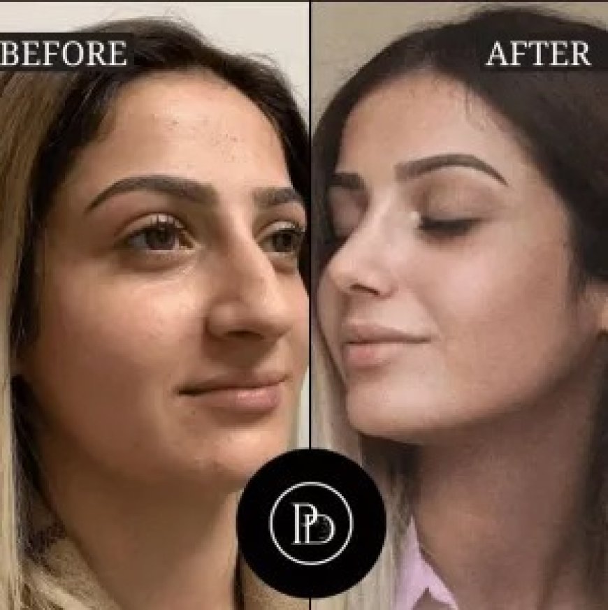 PRP Treatments in Dubai: The Secret to Ageless Beauty