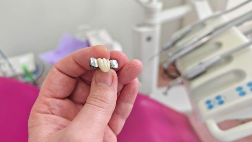 Protect Your Smile — The Importance of Dental Crowns in Oshawa