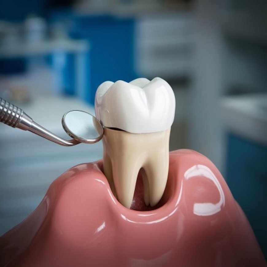 Best Dental Crown Options for Tooth Repair