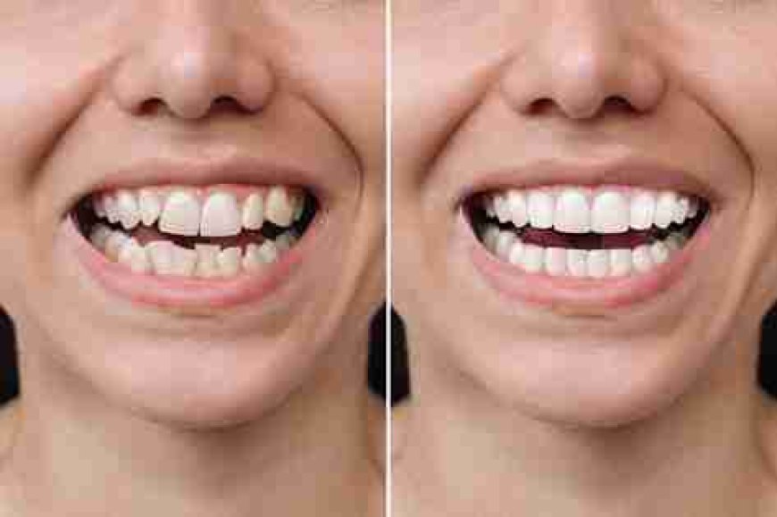 Image Source - Private Dentist Hammersmith