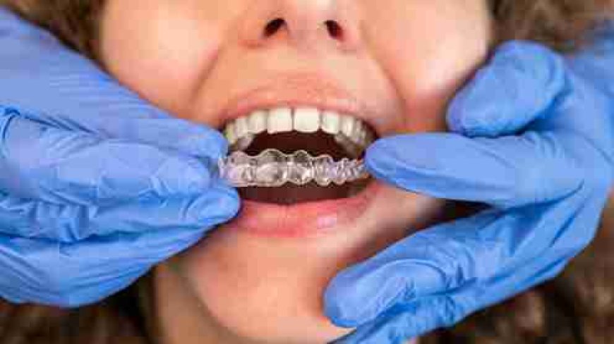 Image Source - Private Dentist Hammersmith