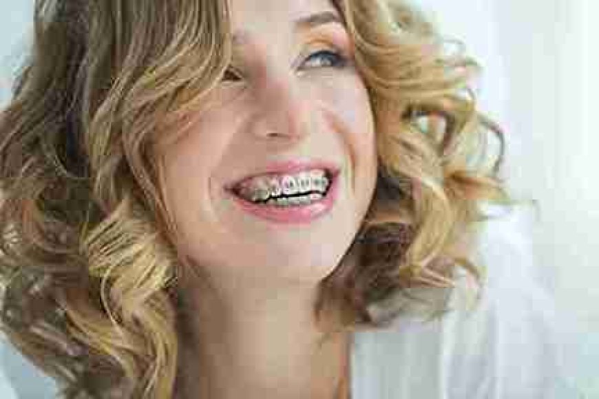 Invisalign: A Modern Fix for Common Bite Challenges